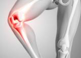 연제구 퇴행성 무릎 관절염 치료 방법알아보기