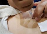 갑자기 허리가 아파요 - 급성요추염좌 치료방법