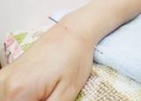 손 손목관절염 증상,원인과 예방법으로 관리해주기 