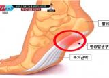 발목이 아픈이유 10가지와 질환들의 특징은? 
