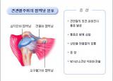 어깨가 찌릿찌릿-어깨점액낭염 증상,원인알아보기