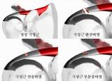 오른쪽&왼쪽어깨가 아파요 회전근개파열 원인/증상