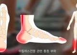 갑자기 발목이 아플때는 운동과 스트레칭을 해보세요.